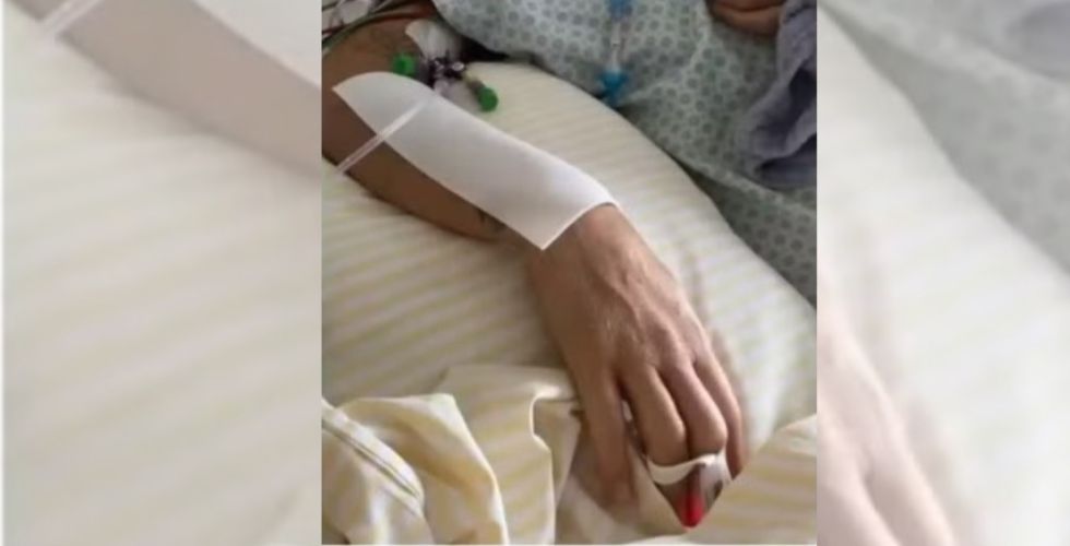 Polilaminina permite que paciente volte a mexer o braço após lesão na coluna