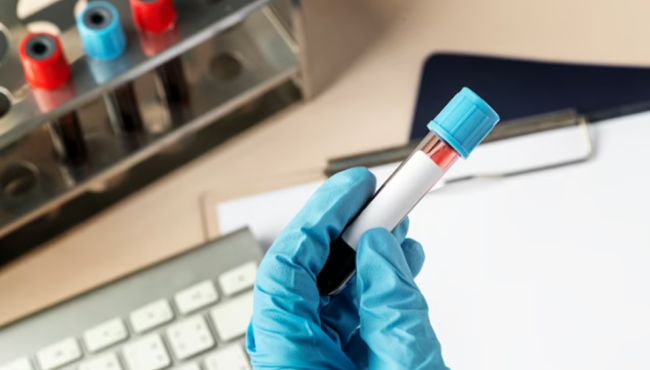 Nova era na Farmácia Clínica: Anvisa libera a realização de exames laboratoriais em Farmácias e Drogarias