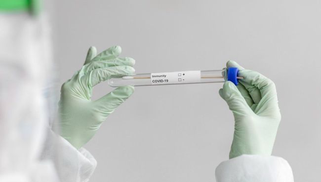 Covid-19: nova lei prioriza testes para farmacêuticos