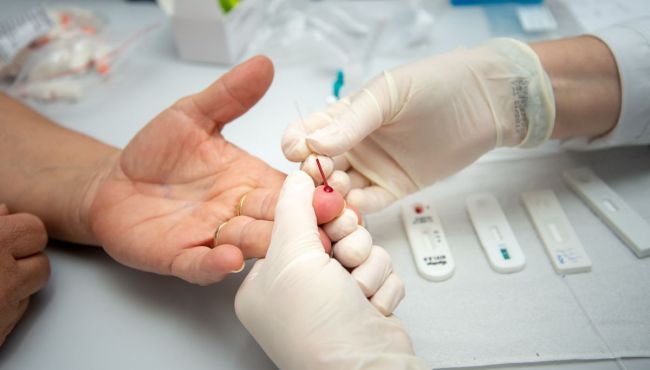 Anvisa orienta farmácias sobre cuidados na aplicação de testes