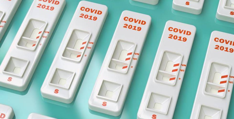 Covid-19: testes adquiridos pelo governo paulista aguardam registro da Anvisa para uso