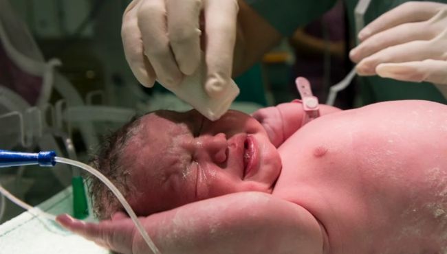 Mudanças em UTI neonatal reduzem infecções graves em prematuros