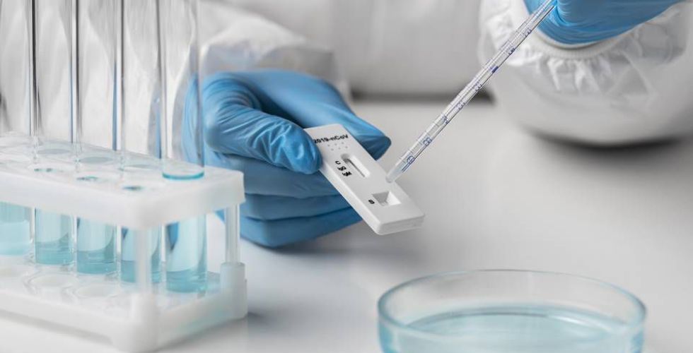 Pague Menos começa a vender testes que comprovam resposta imunológica pós-vacinação