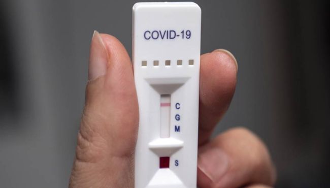 Covid-19: por que o teste rápido da farmácia vai dar errado