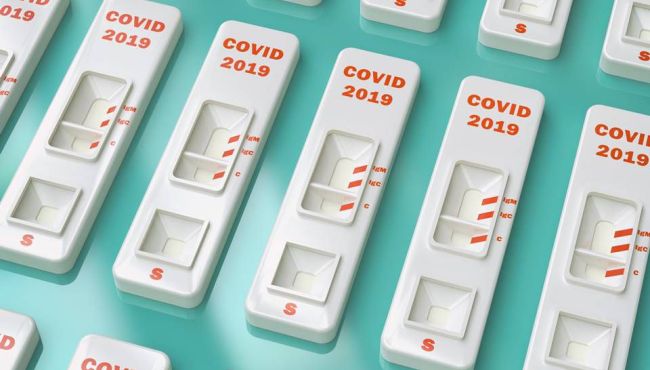 Covid-19: testes adquiridos pelo governo paulista aguardam registro da Anvisa para uso