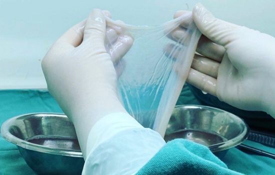 SUS incorpora membrana amniótica e amplia tratamento de feridas e doenças oculares