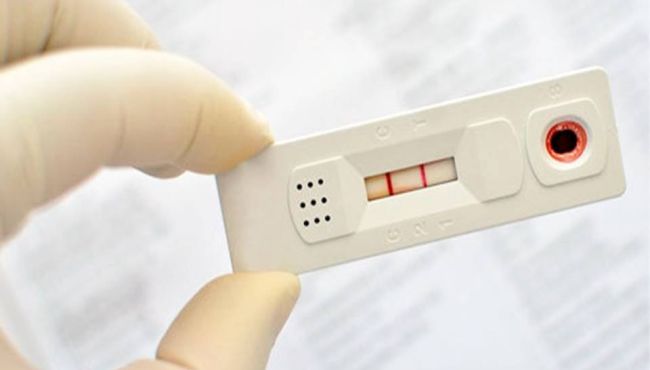 Coronavírus: governo do Ceará proíbe venda de testes nas farmácias
