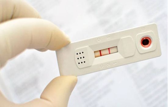 Coronavírus: governo do Ceará proíbe venda de testes nas farmácias