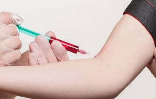 Roche lança teste capaz de identificar 324 genes relacionados ao câncer