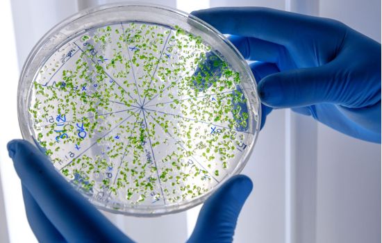 Superbactéria entre as mais perigosas do mundo expõe risco e desafio clínico em UTI neonatal