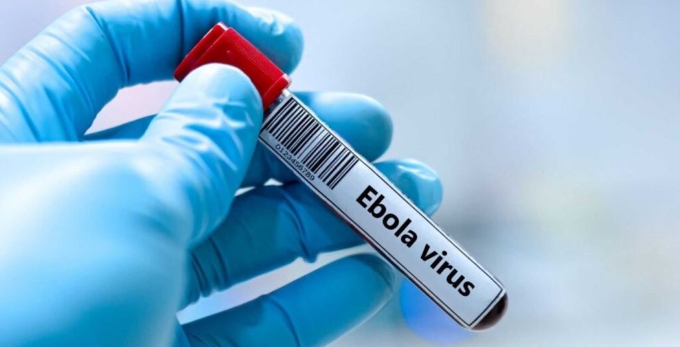 Vacina de Oxford contra Ebola Bundibugyo pode avançar para testes em humanos