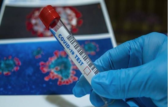 Covid-19: BioNTech compra laboratório da Novartis para ampliar produção de vacina