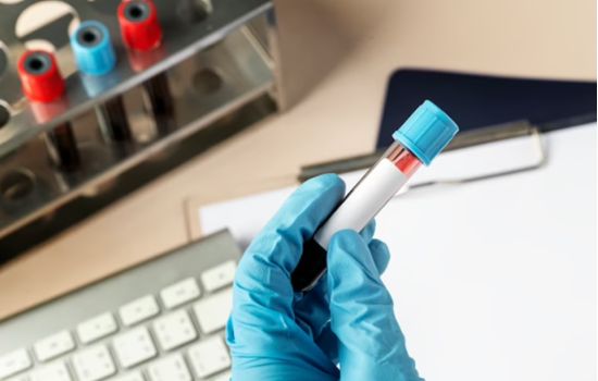 Nova era na Farmácia Clínica: Anvisa libera a realização de exames laboratoriais em Farmácias e Drogarias