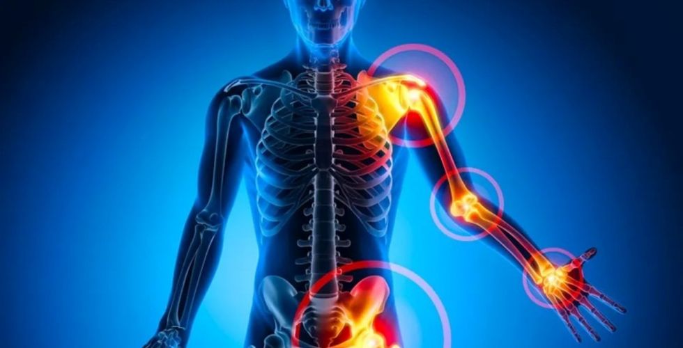 Estudo de Stanford aponta regeneração de cartilagem e pode mudar tratamento da osteoartrite