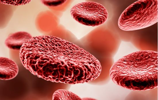 Descoberta iniciada nos anos 80 leva a tratamento inovador para anemia falciforme