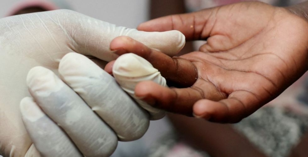Brasil elimina transmissão vertical do HIV, da mãe para o bebê, e alcança menor taxa de mortalidade dos últimos anos