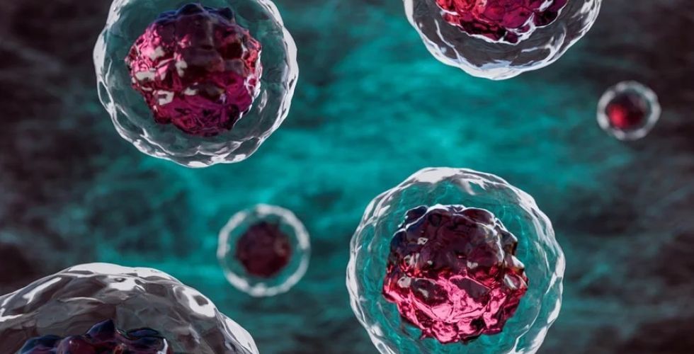 Nova terapia com células-tronco contra Parkinson traz esperança inédita no tratamento da doença