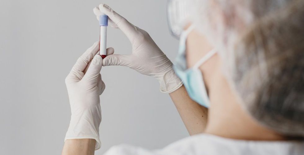 Brasil confirma mais um caso de fungo causador de nova epidemia na Índia