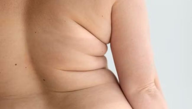Estudo revela que melatonina pode proteger contra obesidade ao regular gordura visceral