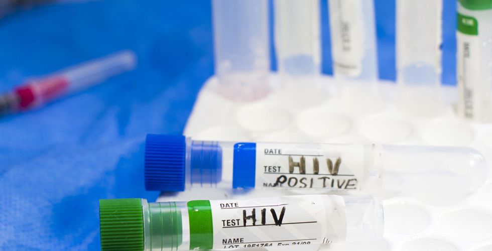 Pesquisadores descobrem nova variante do HIV combinando subtipos predominantes no Brasil