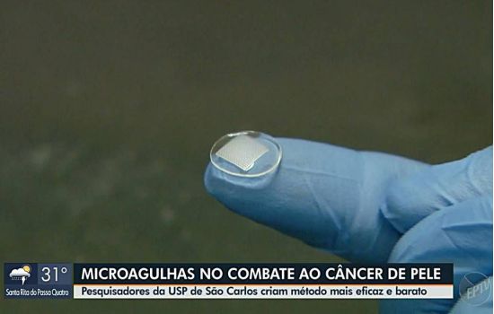 USP desenvolve nova técnica com microagulhas para tratar câncer de pele