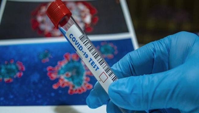 Covid-19: BioNTech compra laboratório da Novartis para ampliar produção de vacina