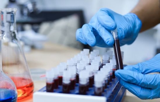 FDA aprova primeiro teste sanguíneo para diagnóstico precoce do Alzheimer