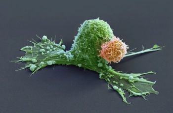 Anticorpo experimental elimina câncer em 80% dos pacientes com mutação genética rara