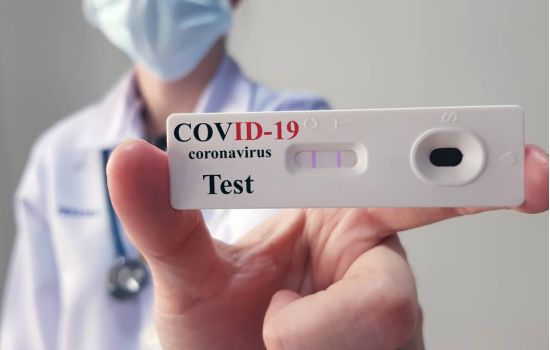 Covid-19: cresce realização de testes em farmácias, mas cientistas questionam eficácia