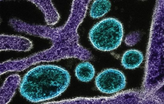OMS avalia como baixo o risco de disseminação do vírus Nipah fora da Índia