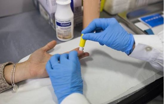 Vigilância Sanitária estabelece novas regras para testes rápidos em farmácias