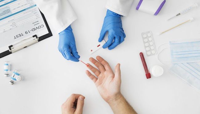 Vigilância Sanitária fiscaliza farmácias que oferecem testes rápidos de Covid-19