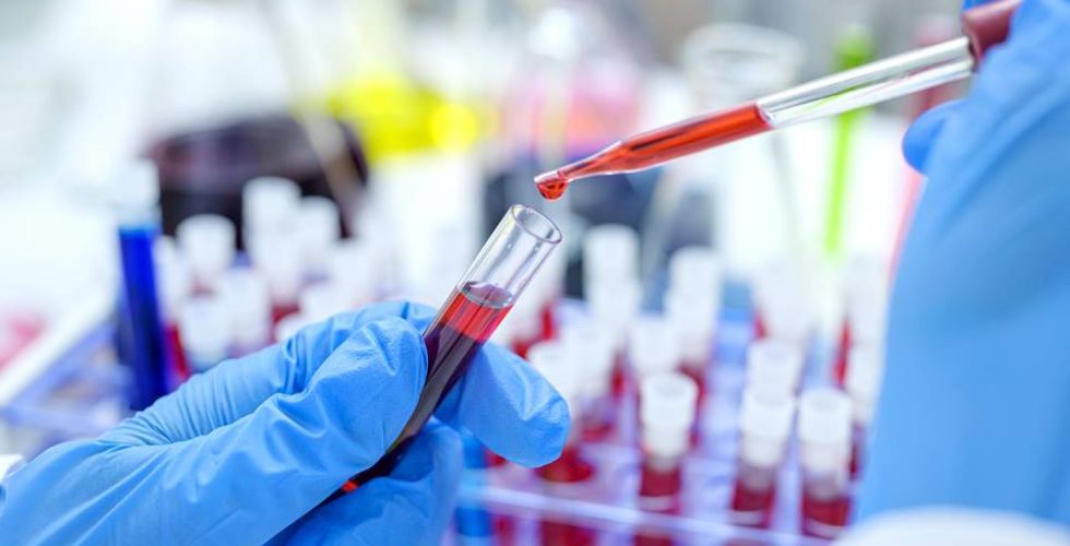 Rússia disponibiliza novo medicamento para tratamento da Covid-19