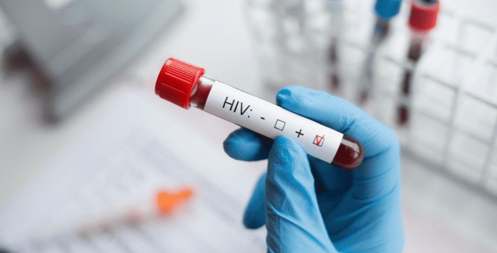 Cura do HIV pode estar em medicamento usado contra o câncer