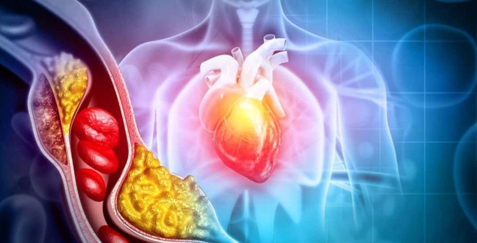 Terapia de edição genética reduz LDL em estudo inicial e abre nova frente contra colesterol alto