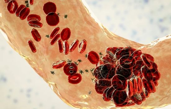 Teste feito em casa com sangue menstrual pode ampliar a prevenção do HPV