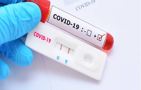 Farmácias devem informar sobre casos suspeitos de Covid-19 no Ceará
