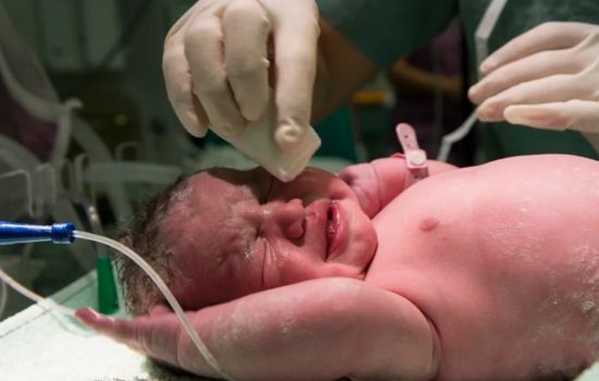 Mudanças em UTI neonatal reduzem infecções graves em prematuros