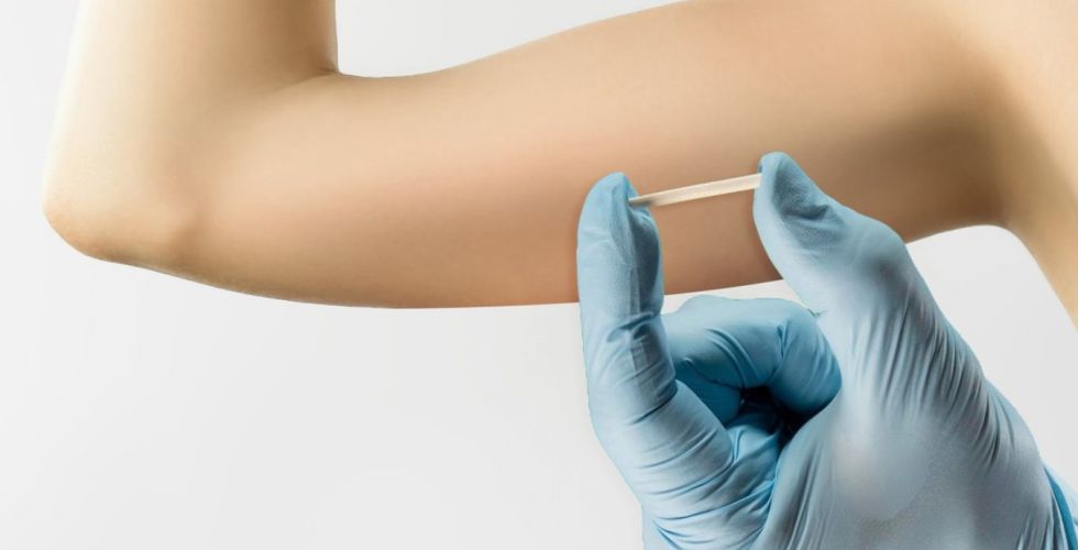 Implante anticoncepcional impulsiona crescimento recorde da Organon no brasil