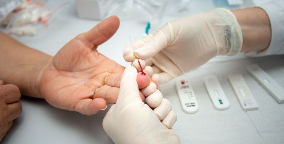 Anvisa orienta farmácias sobre cuidados na aplicação de testes