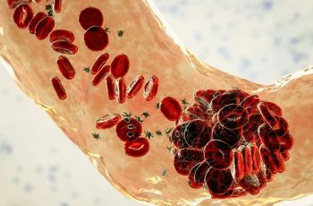 Teste feito em casa com sangue menstrual pode ampliar a prevenção do HPV
