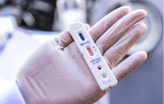 MP cobra medidas sanitárias de farmácias para testes de Covid-19