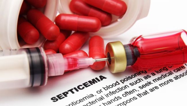 Medicamento inovador reacende expectativas no combate à sepse