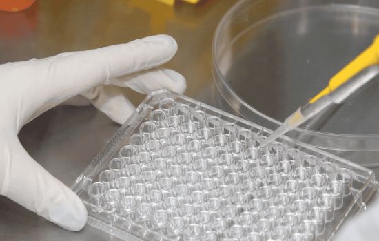 Pesquisadores da USP criam técnica que pode revolucionar o diagnóstico de diabetes.