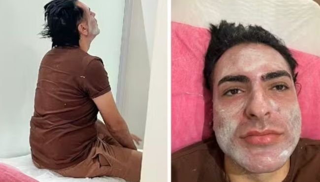 Curso de peeling de fenol é alvo de investigação após m0rt3 de empresário