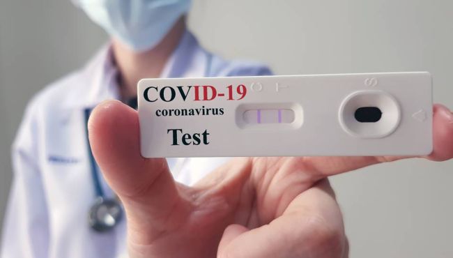 Covid-19: cresce realização de testes em farmácias, mas cientistas questionam eficácia