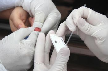 Covid-19: farmácia na UFRN realiza testes rápidos por R$ 250