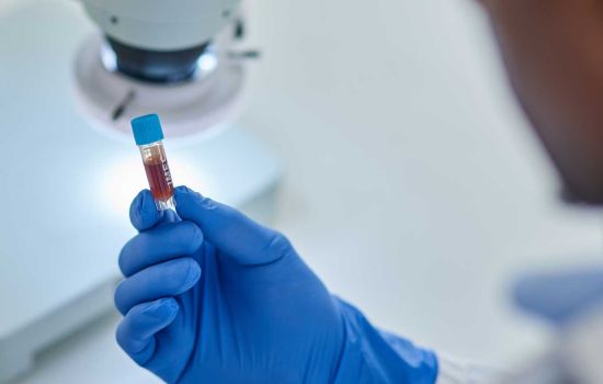 OMS declara mpox como emergência global de saúde pública