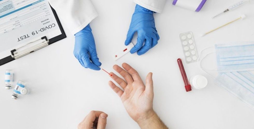 Anvisa alerta que testes para diagnóstico de Covid-19 não atestam proteção vacinal