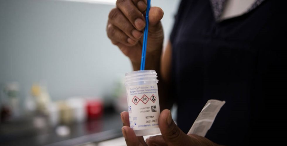 Exame de DNA para HPV detecta até seis vezes mais infecções que o Papanicolau